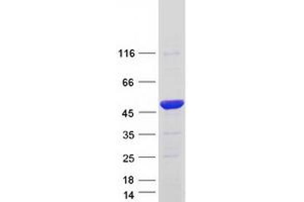 PIP4K2C Protein (Transcript Variant 2) (Myc-DYKDDDDK Tag)