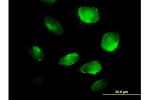 Immunofluorescence of purified MaxPab antibody to TXNDC5 on HeLa cell. (TXNDC5 antibody  (AA 1-360))