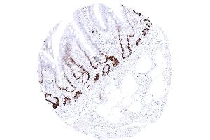 A strong MCM3 immunostaining occurs in duodenal crypt cells (MCM3 antibody)