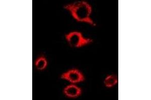 Immunofluorescent analysis of RPL9 staining in MCF7 cells. (RPL9 antibody)
