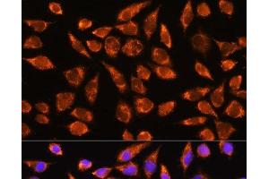 Immunofluorescence analysis of L929 cells using MARK2 Polyclonal Antibody at dilution of 1:100. (MARK2 antibody)