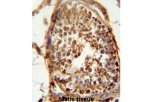 Immunohistochemistry (IHC) image for anti-DnaJ (Hsp40) Homolog, Subfamily B, Member 13 (DNAJB13) antibody (ABIN2995899) (DNAJB13 antibody)