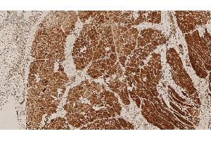 Human skeletal muscle: immunohistochemical staining of HAMLET: HAMLET: clone Ham1/7B6 (Dysferlin antibody  (AA 1999-2016))