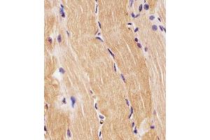 Immunohistochemistry (Paraffin-embedded Sections) (IHC (p)) image for anti-Proline Dehydrogenase (Oxidase) 1 (PRODH) (AA 130-155) antibody (ABIN1881685)