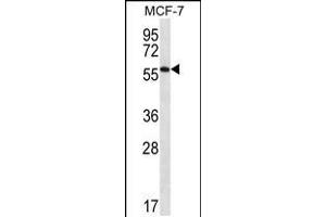 Western blot analysis in MCF-7 cell line lysates (35ug/lane). (SAAL1 antibody  (C-Term))