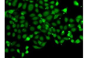 Immunofluorescence analysis of MCF-7 cells using PDCD5 antibody. (PDCD5 antibody)