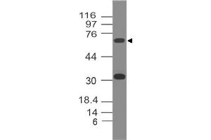 Image no. 1 for anti-Tumor Protein P73 (TP73) (AA 1-209) antibody (ABIN5027420) (Tumor Protein p73 antibody  (AA 1-209))