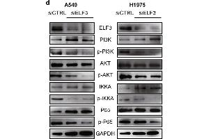 ELF3 can be induced by IL1B and promotes tumor growth through PI3K/AKT/NF-κB pathway. (IKK alpha antibody  (AA 516-745))