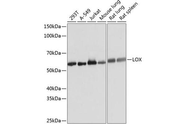 LOX antibody