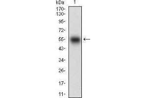 Western blot analysis using SMCP mAb against human SMCP (AA: FULL(1-116)) recombinant protein. (SMCP antibody  (full length))