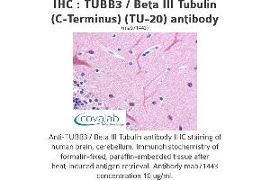 Image no. 3 for anti-Tubulin, beta 3 (TUBB3) (N-Term) antibody (ABIN1724161) (TUBB3 antibody  (N-Term))