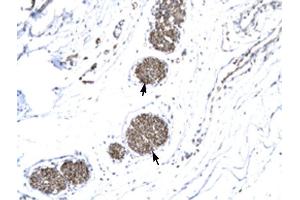 MMP19 antibody was used for immunohistochemistry at a concentration of 4-8 ug/ml to stain Ganglionic cells (arrows) in Human urinary bladder. (MMP19 antibody  (N-Term))