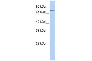 Integrin Beta 8 antibody used at 1 ug/ml to detect target protein. (ITGB8 antibody  (C-Term))