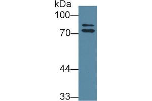 Western blot analysis of Rat Liver lysate, using Rat OS9 Antibody (1 µg/ml) and HRP-conjugated Goat Anti-Rabbit antibody ( (OS9 antibody  (AA 465-666))