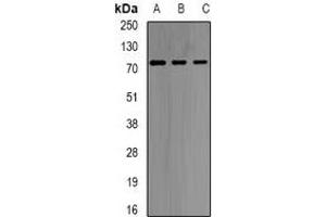 Western blot analysis of GNT1 expression in HT29 (A), MCF7 (B), mouse liver (C) whole cell lysates. (Ugt1 antibody)