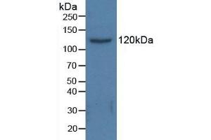 Figure. (HDAC6 antibody  (AA 166-348))