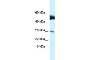 WB Suggested Anti-Amhr2 Antibody   Titration: 1. (AMHR2 antibody  (N-Term))