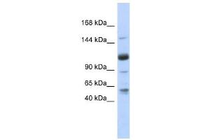 SR140 antibody used at 1 ug/ml to detect target protein. (SR140 antibody  (N-Term))