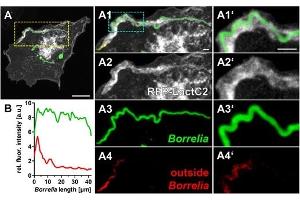 (A) Immunofluorescence micrographs of a primary macrophage expressing RFP–LactC2 (white), with internalized wild-type borreliae, stained by outside staining technique using Borrelia-specific antibody for antibody-accessible spirochetes (red), followed by permeabilization and staining of entire Borrelia cells. (Borrelia Burgdorferi antibody)