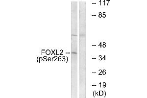 Western blot analysis of extracts from K562 cells, treated with Na3VO4 (0. (FOXL2 antibody  (pSer263))