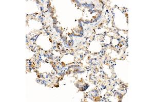 Immunohistochemistry of paraffin-embedded rat lung using [KO Validated] MyD88 Rabbit mAb (ABIN7268723) at dilution of 1:1000 (40x lens). (MYD88 antibody)