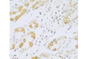 Immunohistochemistry of paraffin-embedded Human stomach using FDXR Polyclonal Antibody at dilution of 1:100 (40x lens). (Ferredoxin Reductase antibody)