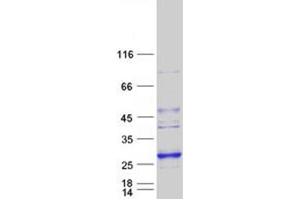 LYPLAL1 Protein (Myc-DYKDDDDK Tag)