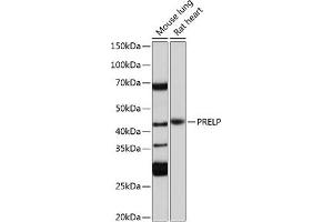 Western blot analysis of extracts of various cell lines, using PRELP Polyclonal Antibody (ABIN7269551) at 1:1000 dilution. (PRELP antibody)