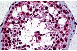 Human Testis: Formalin-Fixed, Paraffin-Embedded (FFPE) (Retinoblastoma Binding Protein 4 antibody  (AA 1-426))