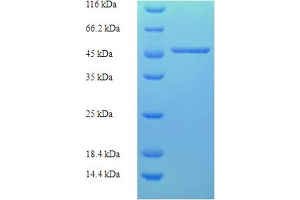 CAPZA2 Protein (AA 2-286) (His-SUMO Tag)