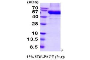 SDS-PAGE (SDS) image for Discoidin Domain Receptor tyrosine Kinase 2 (DDR2) (AA 22-399) protein (His tag) (ABIN5854620) (DDR2 Protein (AA 22-399) (His tag))