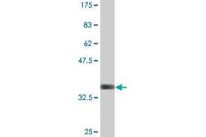 Western Blot detection against Immunogen (36. (HSD17B1 antibody  (AA 189-285))