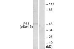 Western Blotting (WB) image for anti-Tumor Protein P53 (TP53) (pSer15) antibody (ABIN2888497) (p53 antibody  (pSer15))