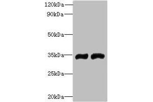 Western blot All lanes: FYTTD1 antibody at 4 μg/mL Lane 1: A375 whole cell lysate Lane 2: Jurkat whole cell lysate Secondary Goat polyclonal to rabbit IgG at 1/10000 dilution Predicted band size: 36, 34, 29, 15 kDa Observed band size: 36 kDa (FYTTD1 antibody  (AA 1-318))