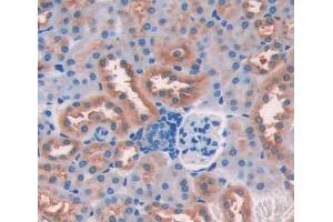 IHC-P analysis of kidney tissue, with DAB staining. (CDK18 antibody  (AA 121-402))