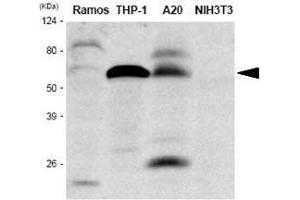 Western Blotting (WB) image for anti-Interferon Regulatory Factor 5 (IRF5) antibody (ABIN2475143) (IRF5 antibody)