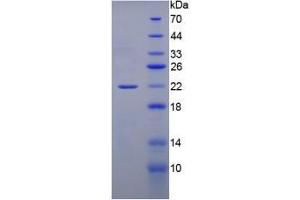 SDS-PAGE analysis of Rat Gremlin 1 Protein. (GREM1 Protein)