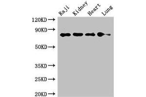 Western Blot Positive WB detected in: Raji whole cell lysate, Mouse kidney tissue, Rat heart tissue, Rat lung tissue All lanes: PECAM1 antibody at 2. (CD31 antibody  (AA 525-586))