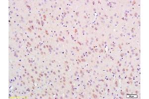 Formalin-fixed and paraffin embedded rat brain labeled with Anti-Nestin Polyclonal Antibody , Unconjugated 1:300 followed by conjugation to the secondary antibody and DAB staining (Nestin antibody  (AA 681-750))