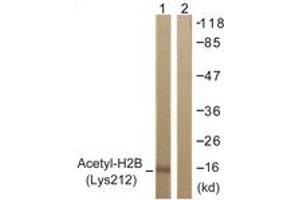 Western Blotting (WB) image for anti-Histone H2B (acLys12) antibody (ABIN2890727) (Histone H2B antibody  (acLys12))