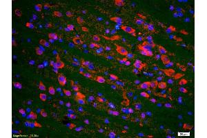 Formalin-fixed and paraffin-embedded rat brain labeled with Anti-phospho-P53(Ser20) Polyclonal Antibody, Unconjugated (ABIN702895) 1:200, overnight at 4°C, The secondary antibody was Goat Anti-Rabbit IgG, Cy3 conjugated used at 1:200 dilution for 40 minutes at 37°C. (p53 antibody  (pSer20))