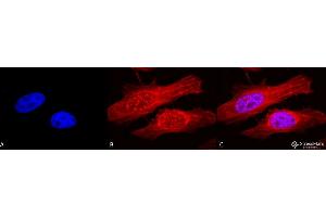 Immunocytochemistry/Immunofluorescence analysis using Rabbit Anti-Alpha B Crystallin Polyclonal Antibody . (CRYAB antibody  (Atto 594))