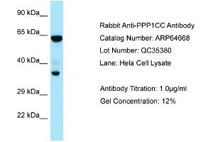 Western Blotting (WB) image for anti-Protein Phosphatase 1, Catalytic Subunit, gamma Isoform (PPP1CC) (C-Term) antibody (ABIN971445) (PPP1CC antibody  (C-Term))