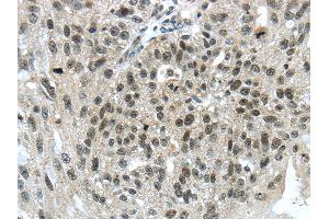 Immunohistochemistry (IHC) image for anti-Tripartite Motif Containing 24 (TRIM24) antibody (ABIN5961956) (TRIM24 antibody)