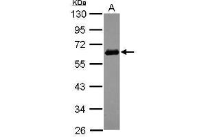 Western Blotting (WB) image for anti-Sequestosome 1 (SQSTM1) antibody (ABIN2854836)