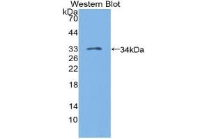 Detection of Recombinant LAG3, Human using Polyclonal Antibody to Lymphocyte Activation Gene 3 (LAG3) (LAG3 antibody  (AA 244-487))