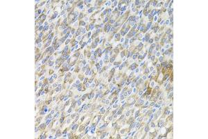 Immunohistochemistry of paraffin-embedded mouse stomach using MBL2 antibody (ABIN5973439) (40x lens). (MBL2 antibody)