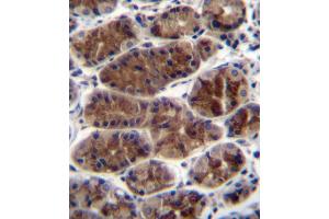 CTGF Antibody immunohistochemistry analysis in formalin fixed and paraffin embedded human stomach tissue followed by peroxidase conjugation of the secondary antibody and DAB staining. (CTGF antibody  (AA 134-159))