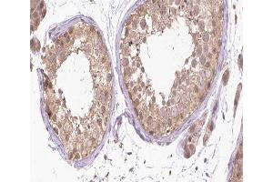 ABIN6266463 at 1/200 staining human Testis tissue sections by IHC-P. (Retinoic Acid Receptor alpha antibody  (pSer77))