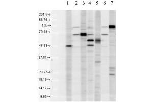 KDEL Western Blot. (KDELR1 antibody)